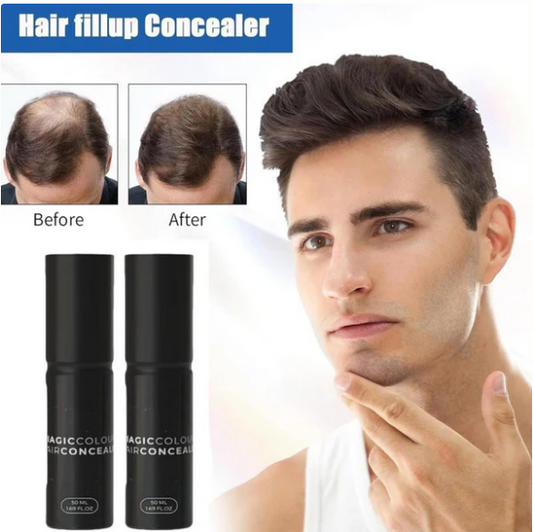 🤩 🤩 🤩VANDAAG VOORDAT VOORDAT UITVERKOCHT! 👇🎁🌸 Up tot 50% korting🔥Hoofdhuid verbergt voor vollere, natuurlijk look -haar